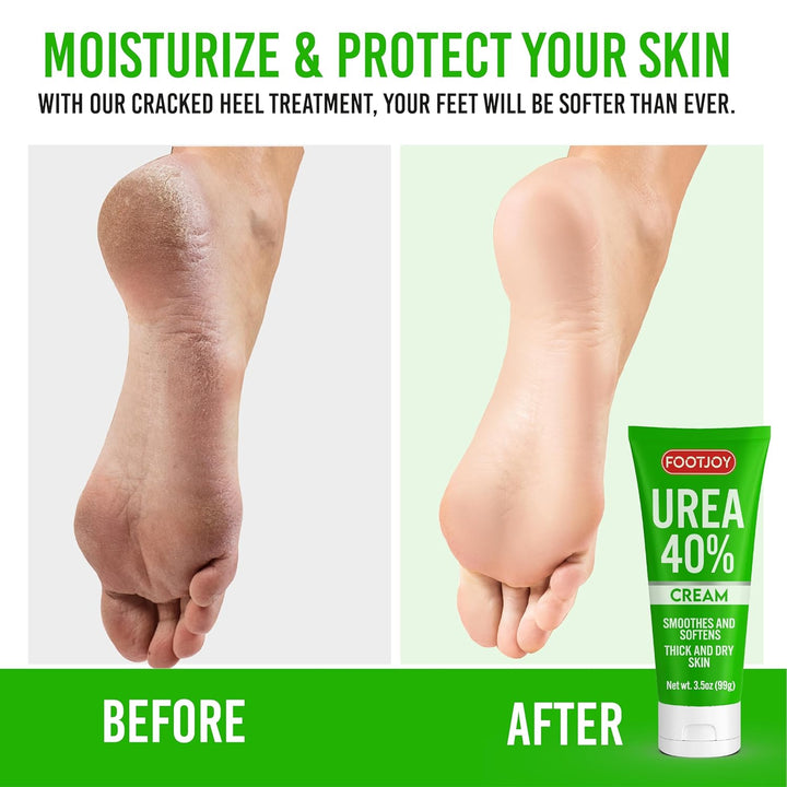 FOOTJOY 40% Urea Foot Cream – Deep Moisturizing Lotion for Cracked Heels, Feet & Elbows (Pack of 2) - PA Cosmetics